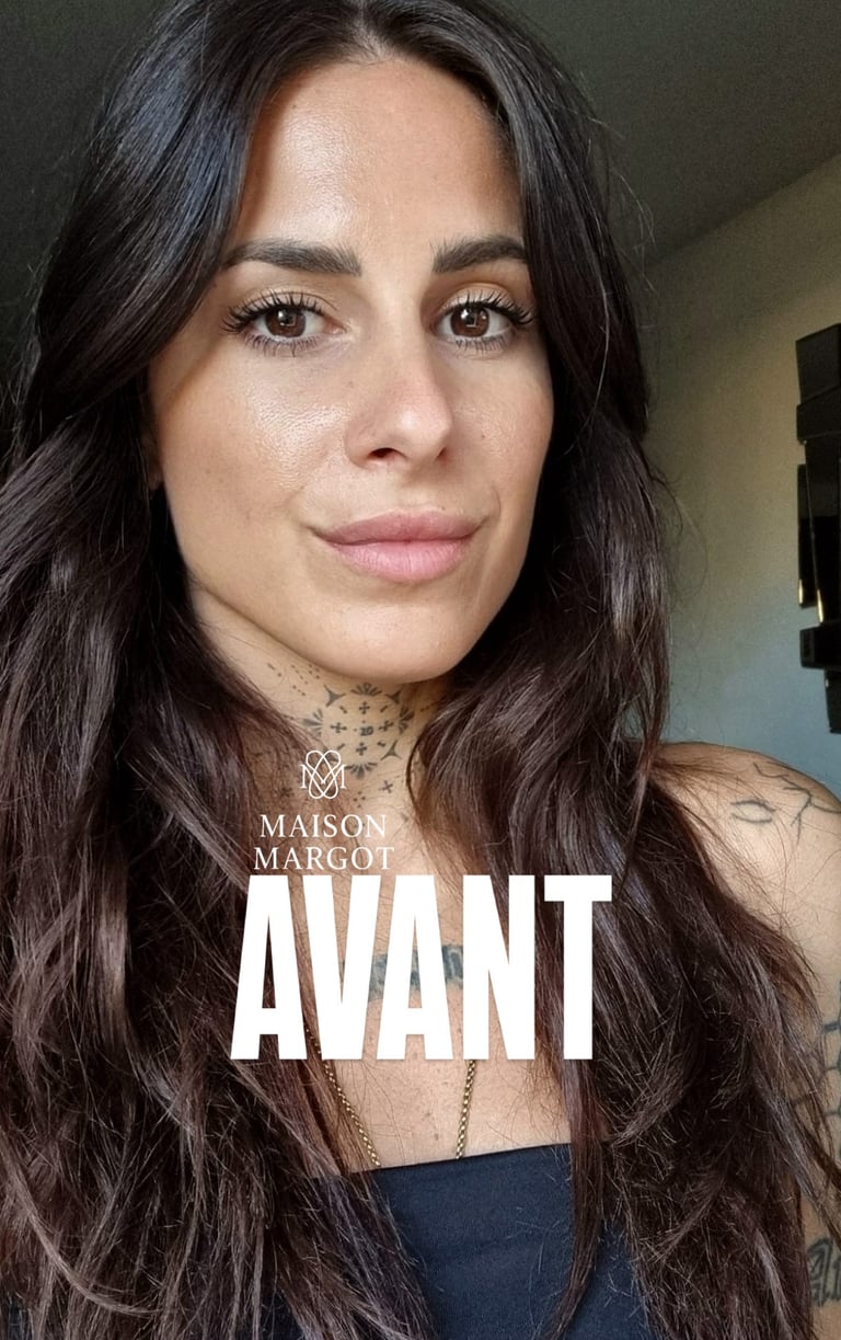 Avant sans taches de rousseur 