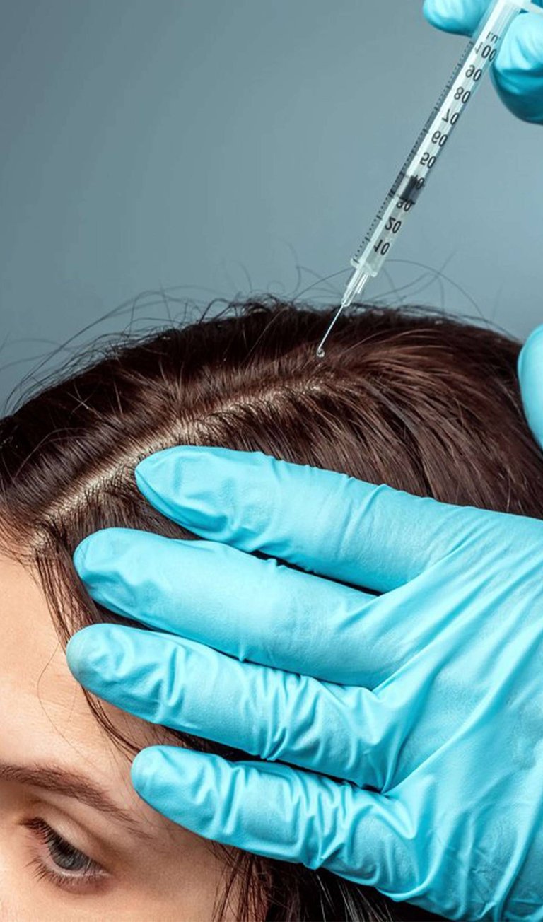 greffe de cheveux,زراعة الشعر الجزائر, perte de cheveux, تساقط الشعر, clinique greffe de cheveux,prp