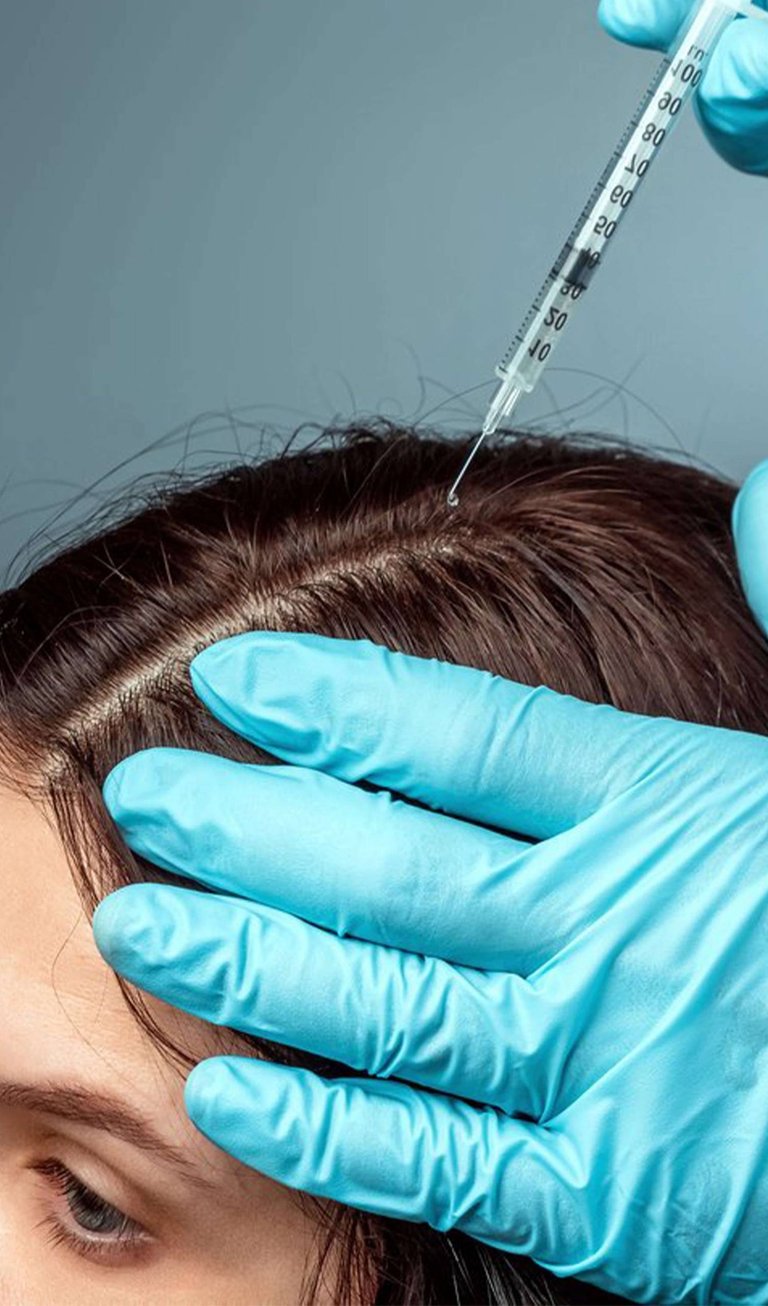 أسعار زراعة الشعر في الجزائر - طبيب تركي لزراعة الشعر في الجزائر - زرع الشعر بأسلوب تركي في الجزائر 