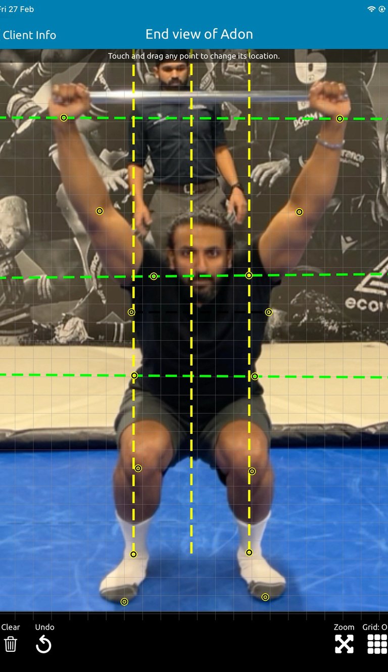 Physiotherapist performing posture and movement assessment to guide rehabilitation in Neath
