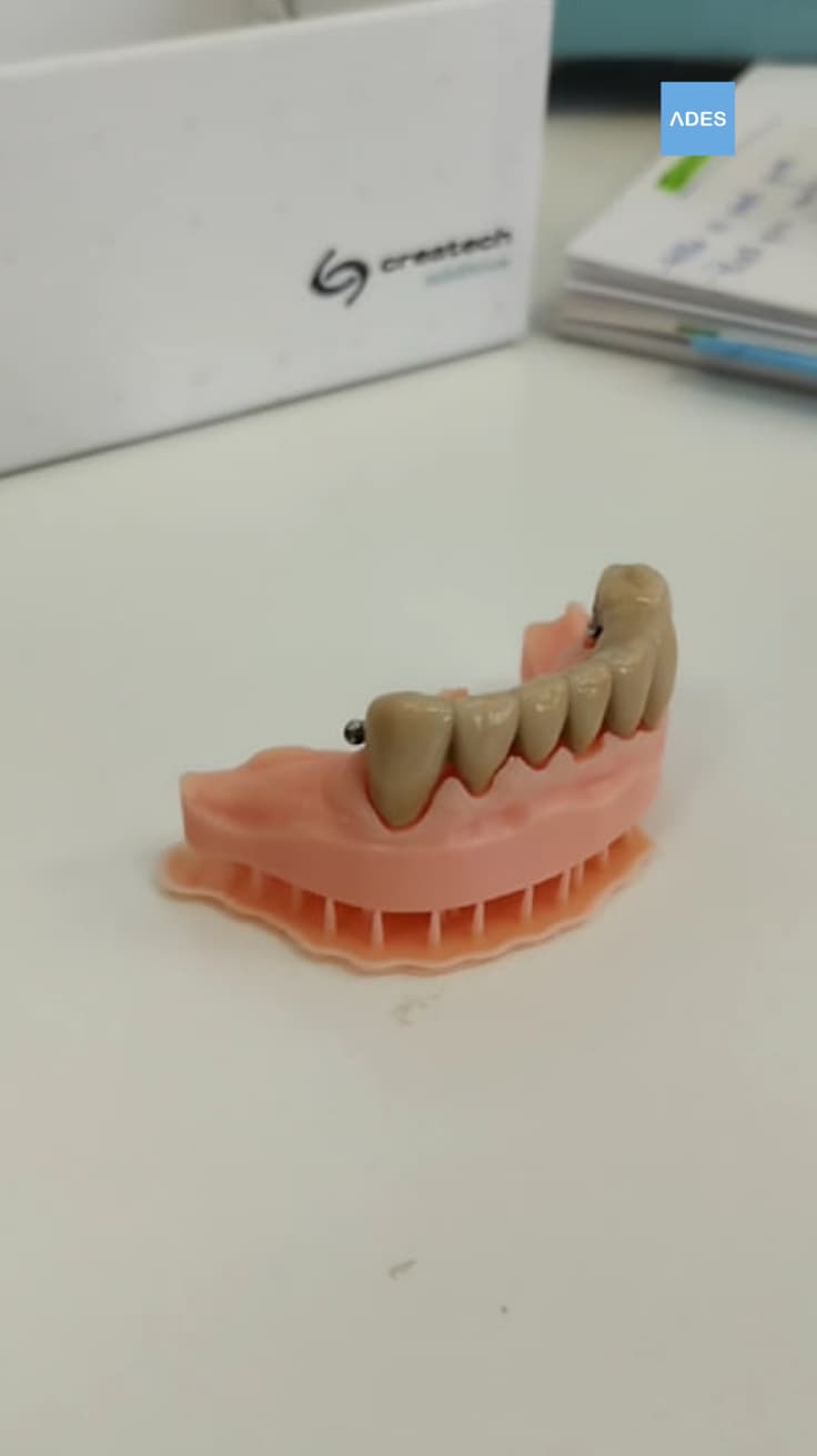 Tratamiento estético dental en Badajoz