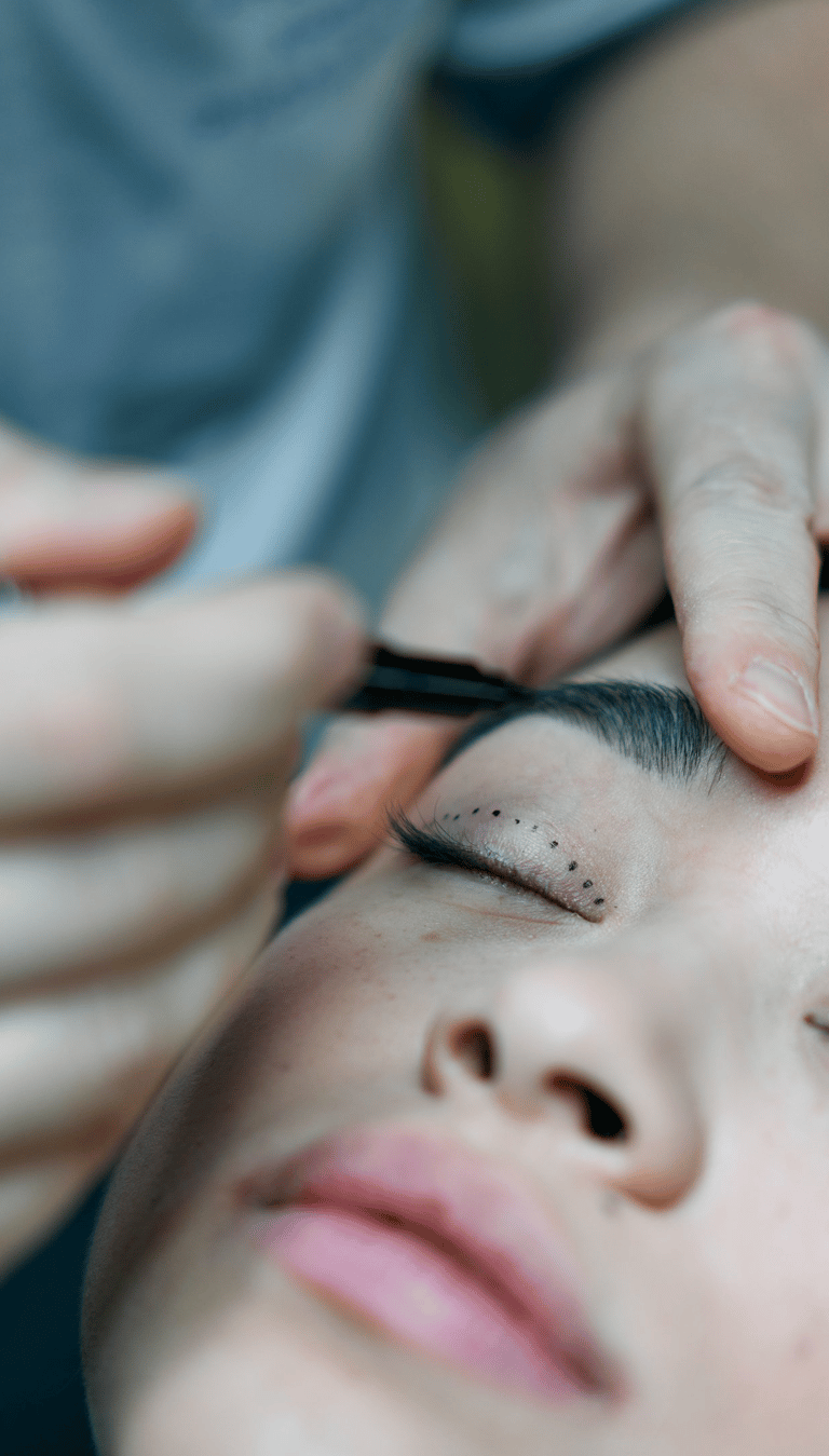 Göz kapağı estetiği uygulaması yapılmış göz