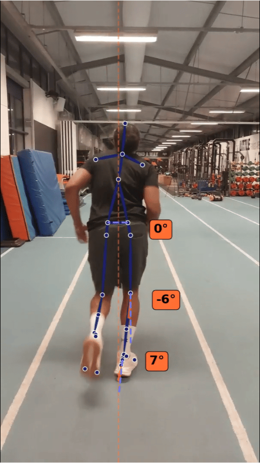Rear-view treadmill running gait analysis measuring alignment and biomechanics
