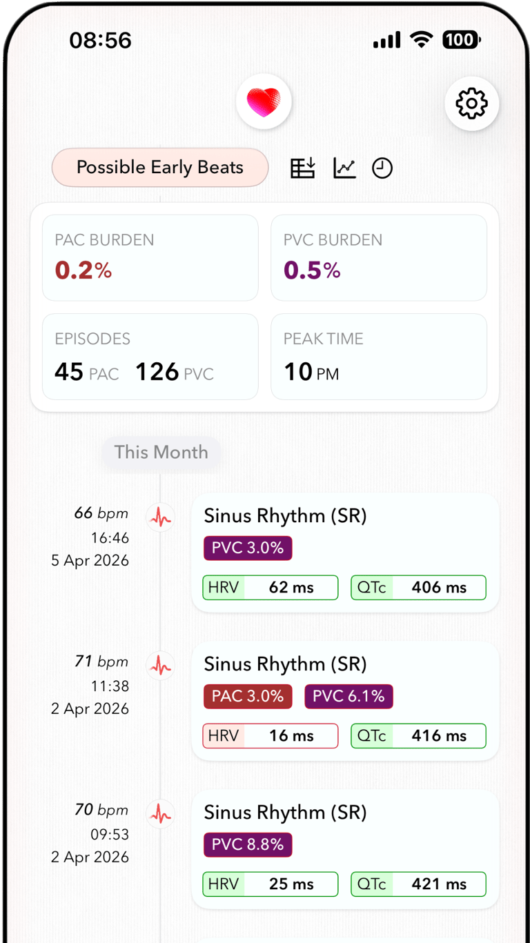 ECG+ app screenshot showing PAC burden (0.2%) calculated for Apple Watch ECG recordings