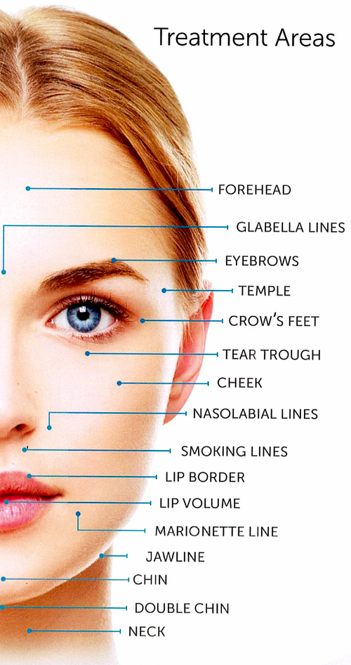 diagram of wrinkle lines