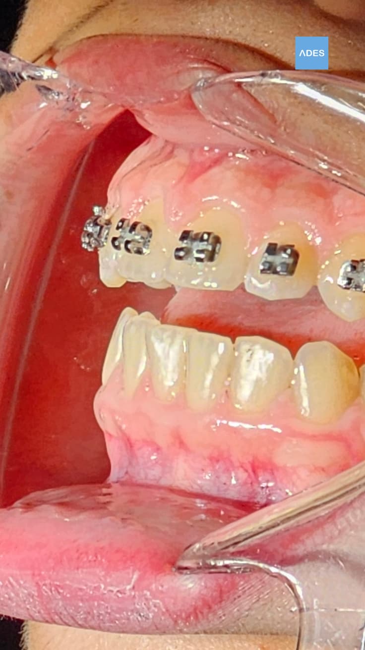 Sala de ortodoncia en Clínica Dental ADES