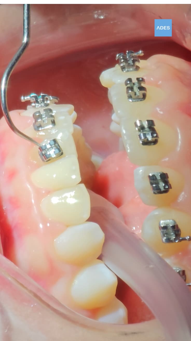 brackets metalicos badajoz