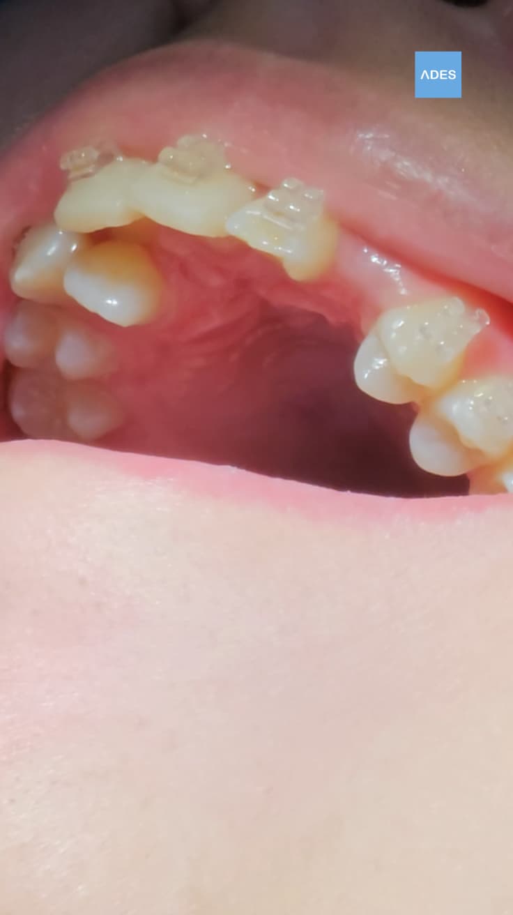 Niños en clínica dental en Badajoz