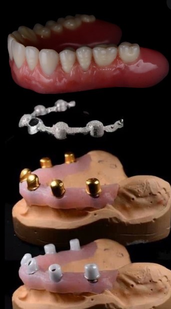 picture of a telescopic bridge