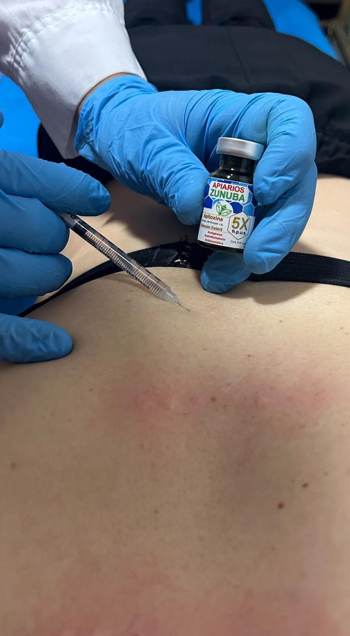 Reacción alérgica y efectos tóxicos del veneno de abeja