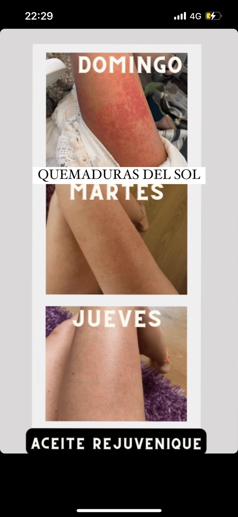 a woman with a red spot on her leg and a picture of a woman without
