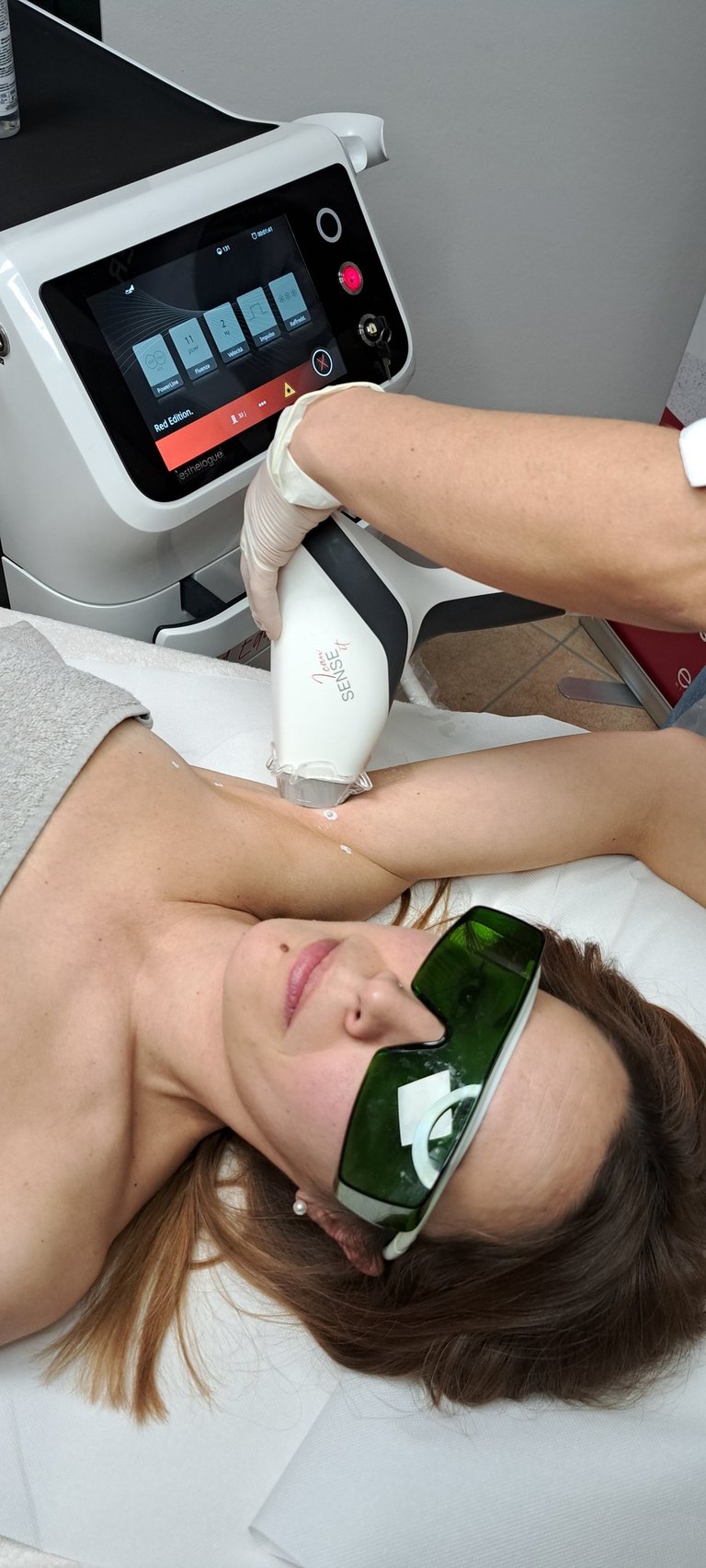 epilazione laser al diodo definitiva per viso e corpo a Riccione