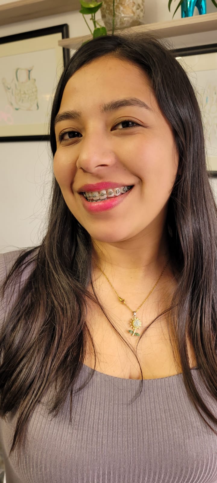 Sonrisa perfecta después de ortodoncia en DUPRINS Lima - Brackets y alineadores dentales