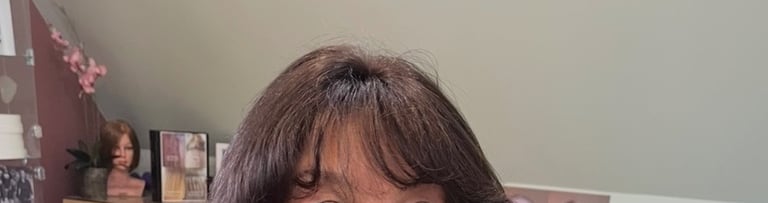 After permanent non-surgical hair replacement #25 with Micropoint Helix solution – enhanced density 