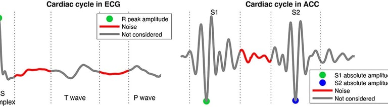 Representation of the signal of interest and noise segments of the cardiac cycle in the ECG and ACC