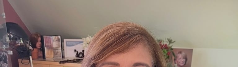 Before permanent non-surgical hair replacement #19 – advanced thinning at the top, limited styling o