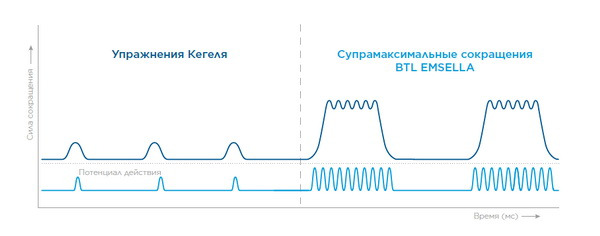 фото схема яка зрівнює вправи кегеля та пристрій BTL EMAELLA