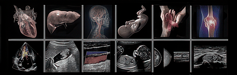 A panel of images Abdominal, Vascular, Obstetric, Breast, and MSK ultrasound training course images.