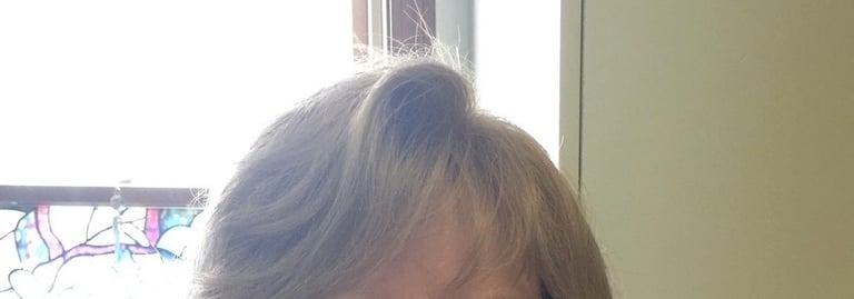 After permanent non-surgical hair replacement #2 with strand by strand method – restored volume at t