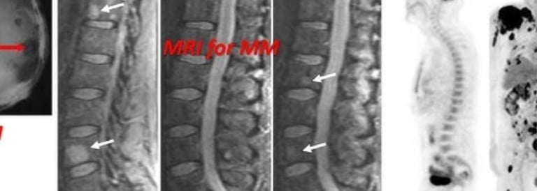 a series of images of a bone fracture