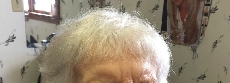 After permanent non-surgical hair replacement #3 with integration method – integrated system adding 