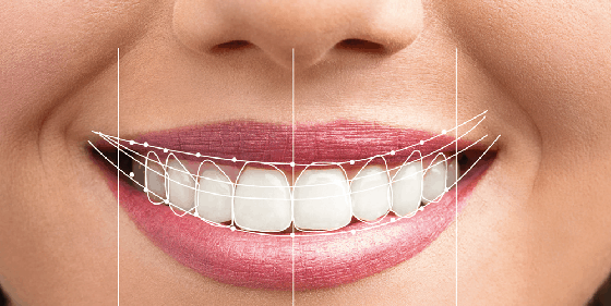 Dental Smile Design Treatment in Wadgaon sheri