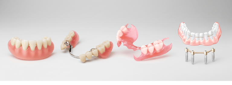 diferentes tipos de prótesis dentales y soluciones de rehabilitación oral