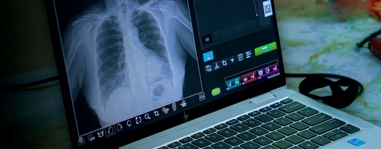 Tampilan hasil rontgen dada pada layar laptop di ruang pemeriksaan medis