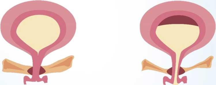 фото Схема мускулатури тазового дна