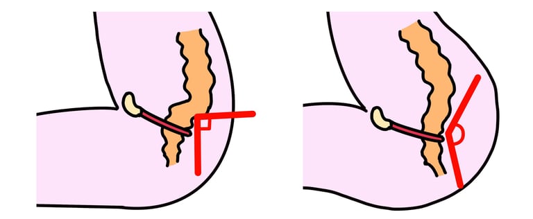 anorectal angle and puborectalis of the pelvic floor