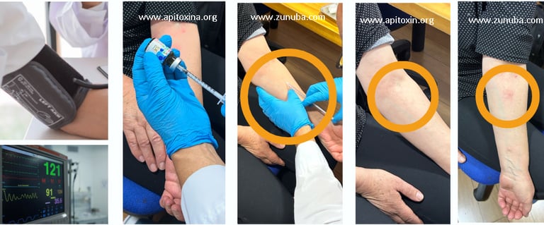 Pruebas y Analisis de Sensibilidad a la Apitoxina