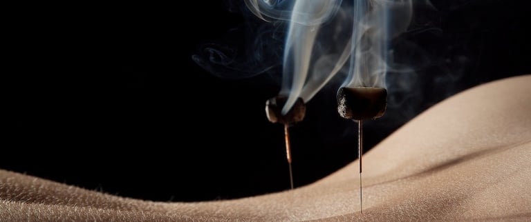 moxa and acupuncture north london clinic