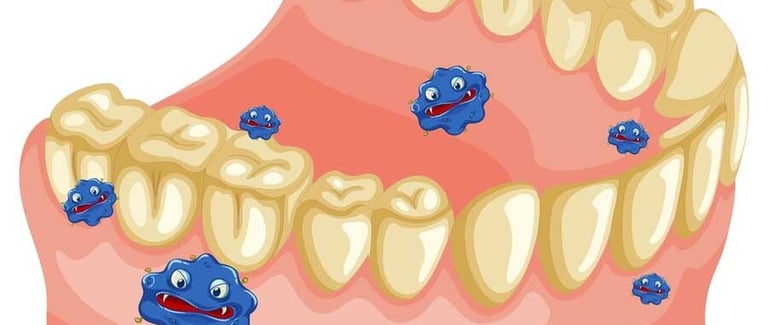 bacteries responsables de la plaque dentaire soins jet dentaire ozone hygiene-precision