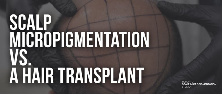 Scalp micropigmentation grid design for hair loss treatment comparison with hair transplant surgery.