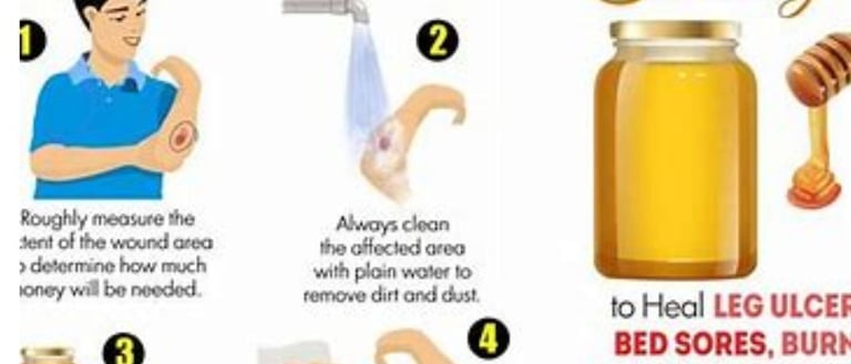   honey use to aleviate pain