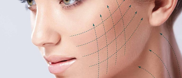 microlifting fire rezorbabile