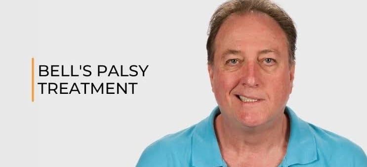 Physiotherapy treatment for bell's palsy at home- Myo Physio expert care.