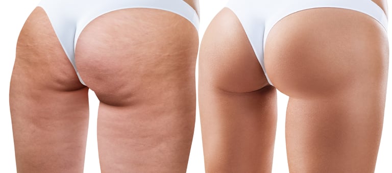 a woman with a very large butt buttocks