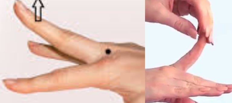_🤲 Trigger Finger & the Role of Voluntary Fasting A Natural Healing Approach