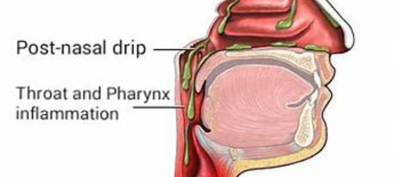 a diagram of the anatomy of the throat of the head and neck oost nasal discharge