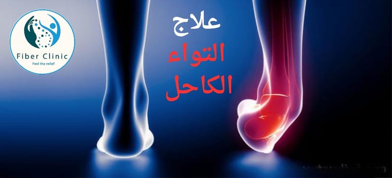 صورة علاج التواء الكاحل
