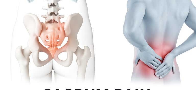 Illustration showing inflammation in the sacroiliac joint causing lower back pain.