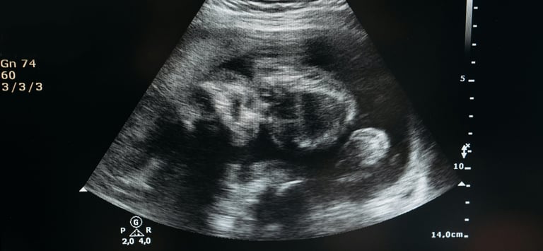 Meteral and fetal growth dataset