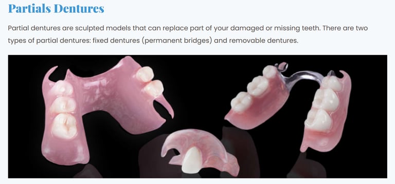 picture of partial dentures
