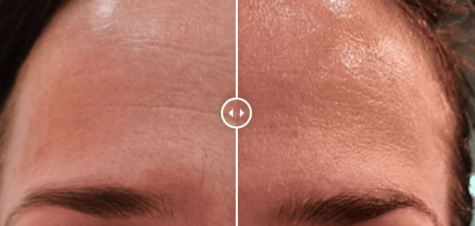 Avant, Après soins visage