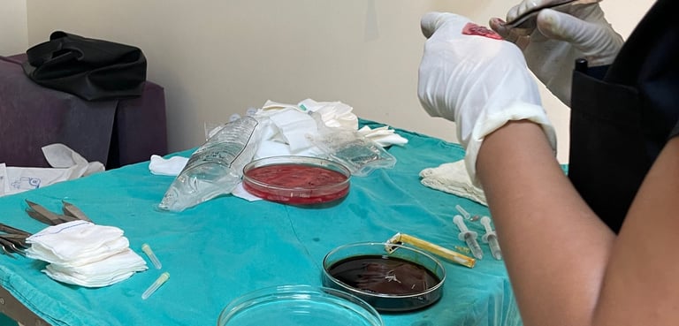 Extracting hair follicles for a hair transplant in Izmir, Turkey