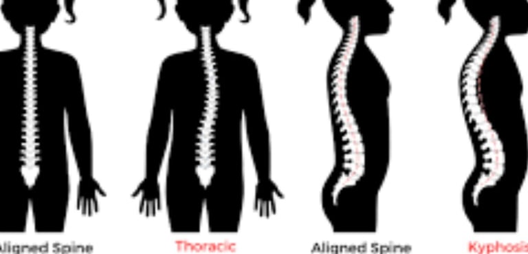 🦴❄️ Kyphosis and Kyphoscoliosis The Only Hope – Cold Water & Fasting Therapy 🍽️💧