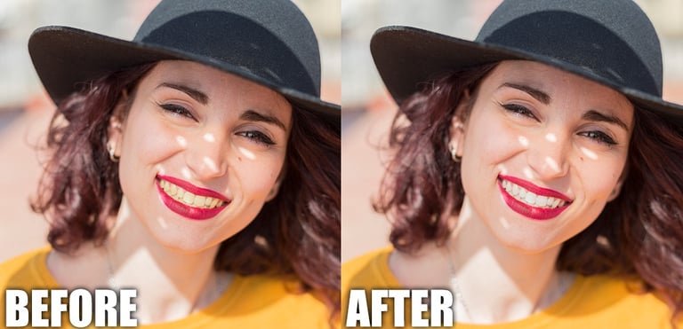 before and after teeth whitening fashion editing