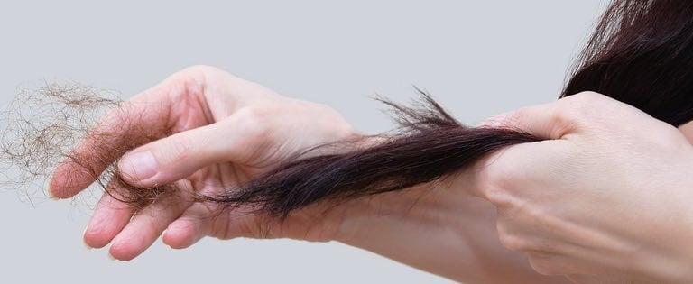 hair loss