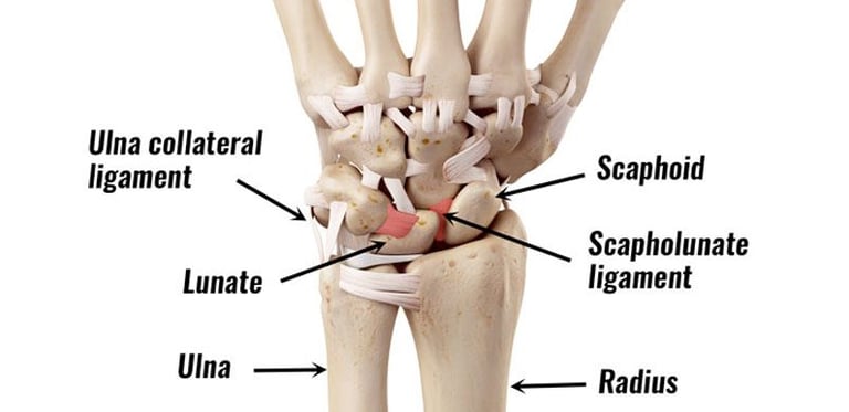 Dr.Rajinikanth's ortho clinic ligament injury-TFCC